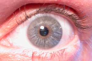 Iridology